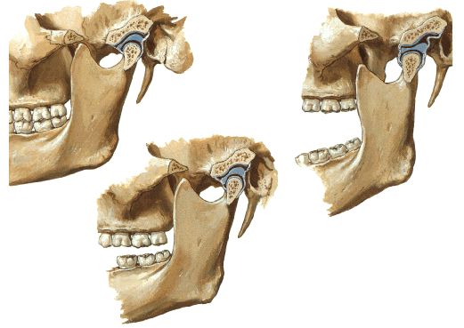 Mandíbula travada também pode ser um sintoma de DTM - Ortodontia Girondi -  Clínica odontológica completa em Bragança Paulista